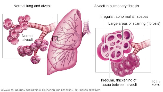 山东最新肺病研究：发病率、诊疗现状及未来趋势预测