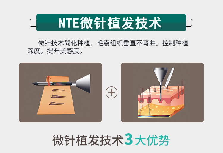 解码最新种发技术：植发技术革新与未来趋势展望