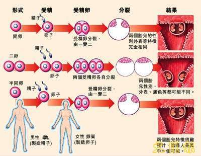 探秘最新双胞胎：基因科技与社会伦理的碰撞