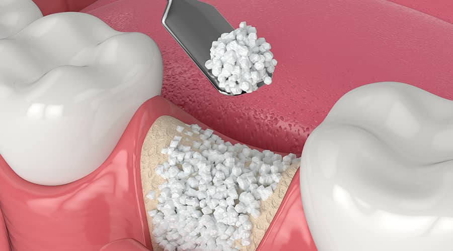 骨高最新研究：从基元研究到临床应用的全面观察