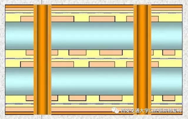 沙井PCB钻孔最新招聘信息：薪资待遇、技能要求及行业前景分析