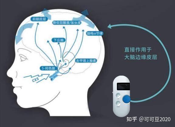 抑郁症最新突破：基因疗法、脑刺激技术及精准治疗的曙光