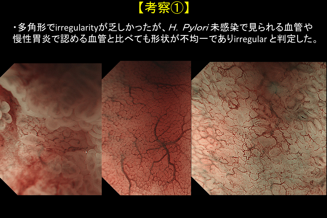 探秘最新胃镜技术：高清无痛检查的未来展望